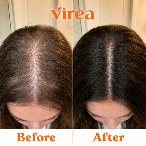 Virea Exosome-Infused Hair Serum